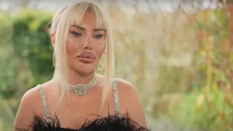Estetiklerini tek tek sıralamıştı! TikTok fenomeni Pınar Özkurteller şimdi de gözlerini boyattı